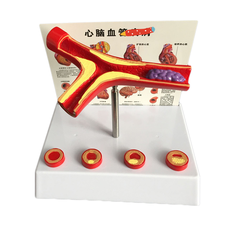 Medical Lab And Science - อุปกรณ์ห้องปฏิบัติการแบบจําลองหลอดเลือดหลอดเลือดมนุษย์ขยาย 50 เท่า