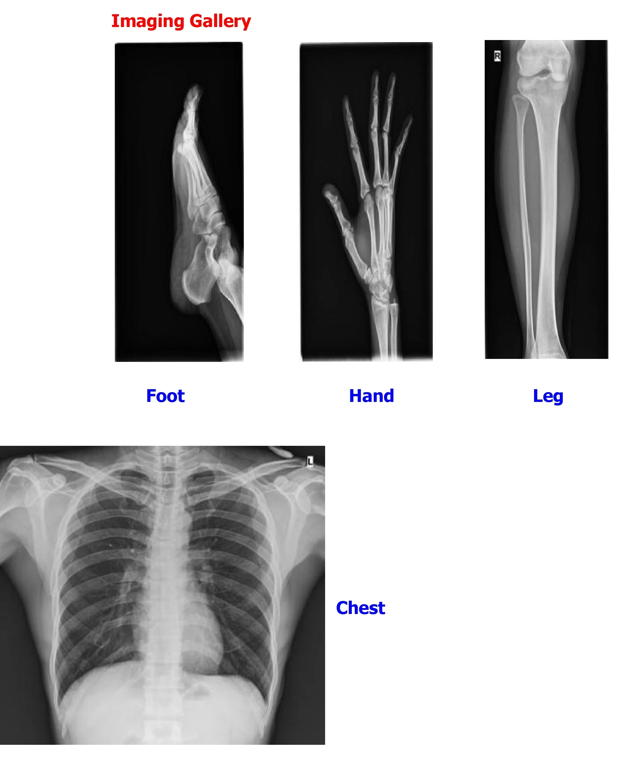 เครื่องเอกซเรย์เคลื่อนที่ทางกา - X Medical Lab บทวิจารณ์และราคา